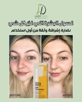 غسول بشرة